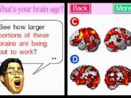 Is Brain Age as smart as it claims?