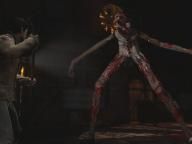 UGO:  Silent Hill: Homecoming review