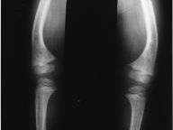 In addition to making you fat, violent and anti-social, video games also cause bone disease