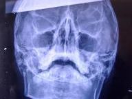 Gamer Stabbed In the Head for Cheating at Counter Strike in China