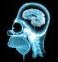 Mindboggle
