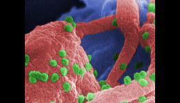 Genetically Engineered Stem Cells A Potential Cure For AIDS