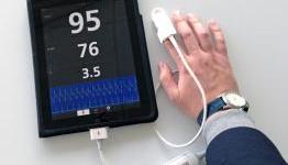 CES 2013 Interview With Mike from Masimo On The ISpO2 Pulse Oximeter