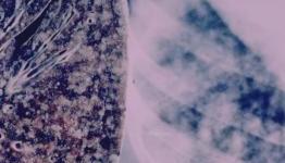 Human lungs grown in lab thanks to breakthrough procedure