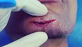 Former Chelsea defender Michael Mancienne suffers nasty cut to his chin during Hamburg training