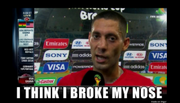 USMNT’s Clint Dempsey has broken nose; Jurgen Klinsmann has treatment plan in mind