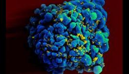 Temple University Researchers Eliminate The HIV Virus From Cultured Human Cells For First Time