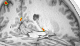 Brain scan reveals out-of-body illusion