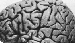 Premature birth alters brain connections