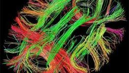 Scientists find genetic basis of brain networks seen in imaging studies