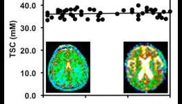 Cell density remains constant as brain shrinks with age