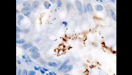 Scientists develop new technique for analyzing the epigenetics of bacteria