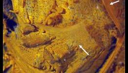 Survival of the gutless? Filter-feeders eject internal organs in response to stress