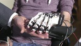 Bionic breakthrough for paralysed patients