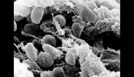 How small genetic change in Yersinia pestis changed human history