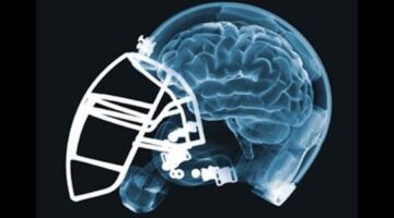 Are Young Athletes Risking Head Injuries