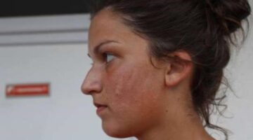 Outrage over ‘inhumane’ slapping of female footballer by Serbian official