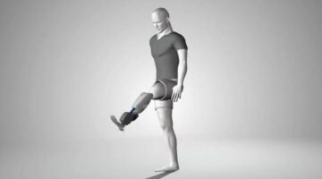 New Muscle Grafting Process Could Revolutionize Prostheses