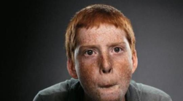 Video Game Disorder Set To Be Officially Recognized