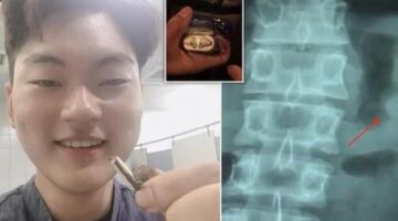Some bozo swallowed an AirPod and pooped it out – it still worked