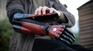 Man Born Without Hand Gets Real-Life Metal Gear Solid Bionic Arm
