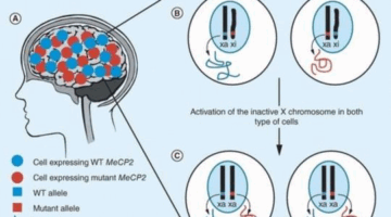 Scientists Develop a Gene Therapyfor Rett Syndrome
