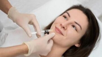 Facial Fillers Dubai