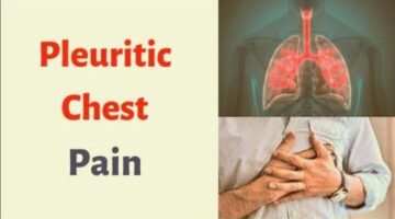 Shortness of Breath