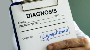 Lymphoma: Types, Genetic Risks, and Treatment