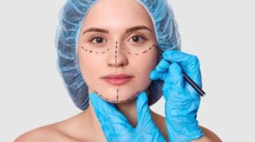 Best Rhinoplasty Surgeon in Jaipur – Rhinoplasty Doctor in Jaipur