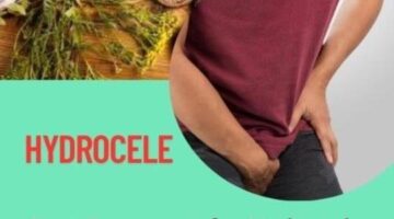 Best Treatment for Hydrocele in Adults: Options That Work