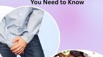 Effective Hydrocele Treatment for Adults: What You Need to Know – Herbal Care Products – Blog