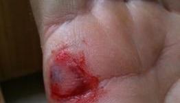 The Dangers Of Playing Kinect Enthusiastically
