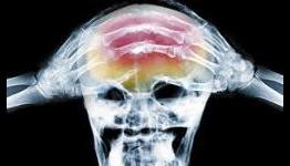 More 3DS headache complaints roll in