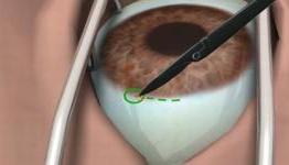 Surgery Simulator review -PCGAMER-