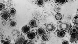 Brandon Cronenberg’s Antiviral Casts Up, Launches Principal Photography