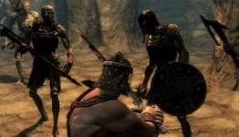 Skyrim: The Story Of How A Guard Took An Arrow To The Knee