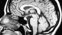 Scientists create 3D map of orgasmic female brain